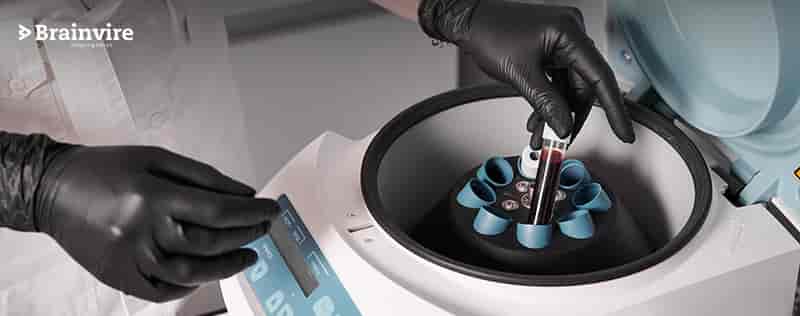 Brainvire’s Odoo Integration Automates Accurate Plasma Donor Data Transfer For ABO Holding