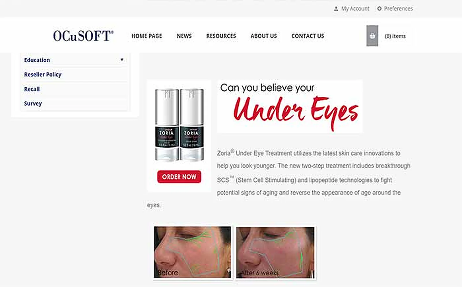 Eyecare Brand delivered interface, screen 3
